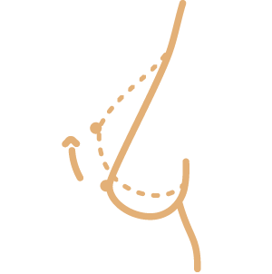 Hyaluronsäure